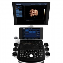 5D Ultrasound system